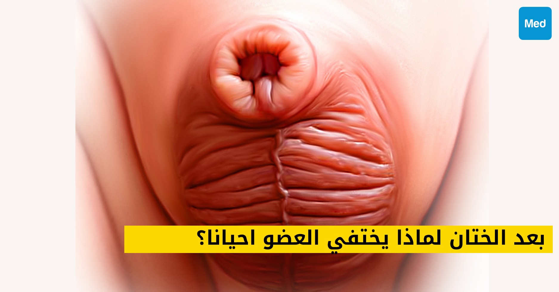 بعد الختان لماذا يختفي العضو احيانا؟
