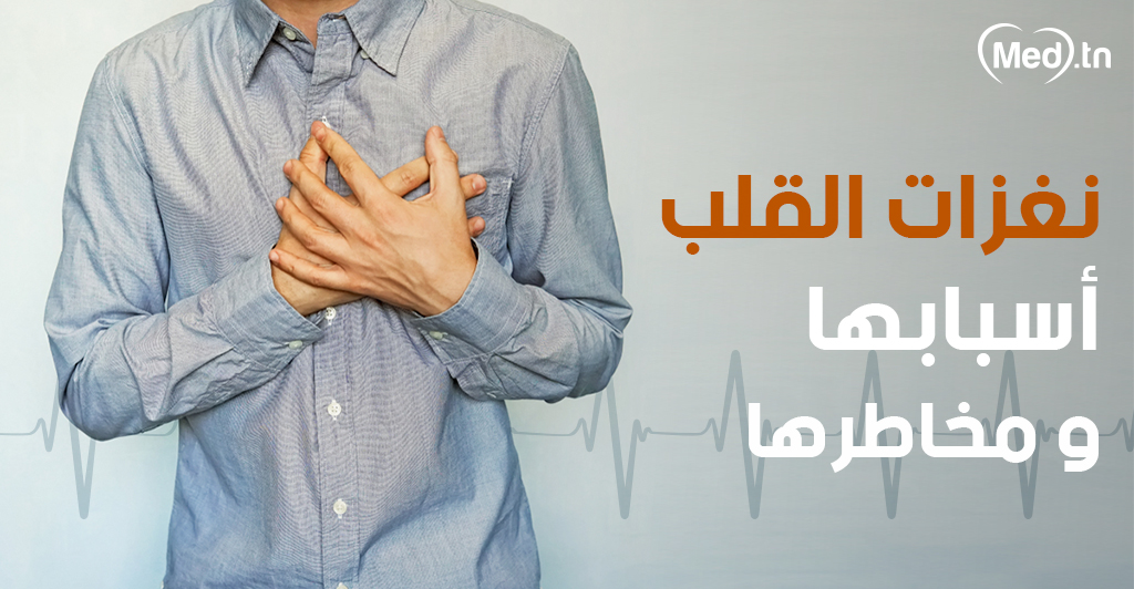 النوبات القلبية المجلة الطبية المسببة والمخاطر