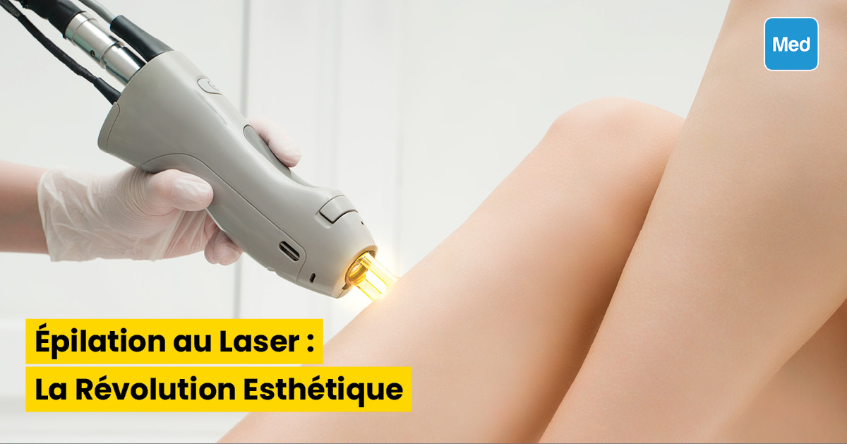 Épilation au Laser : La Révolution Esthétique