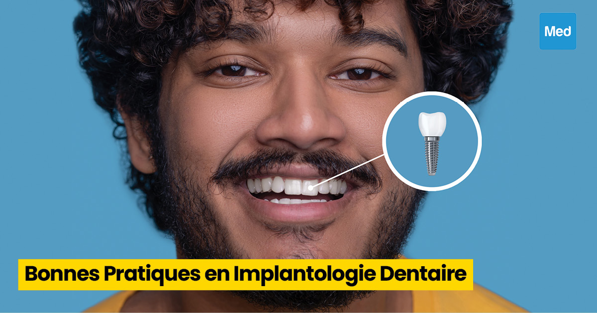 Bonnes Pratiques en Implantologie Dentaire