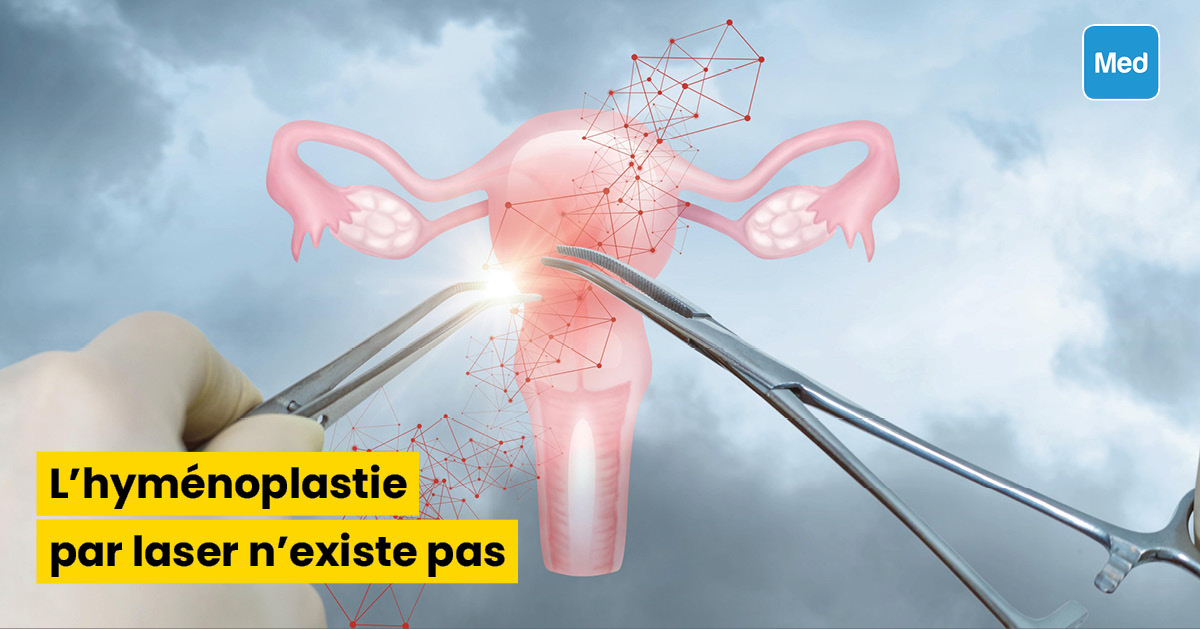 L’hyménoplastie par laser n’existe pas