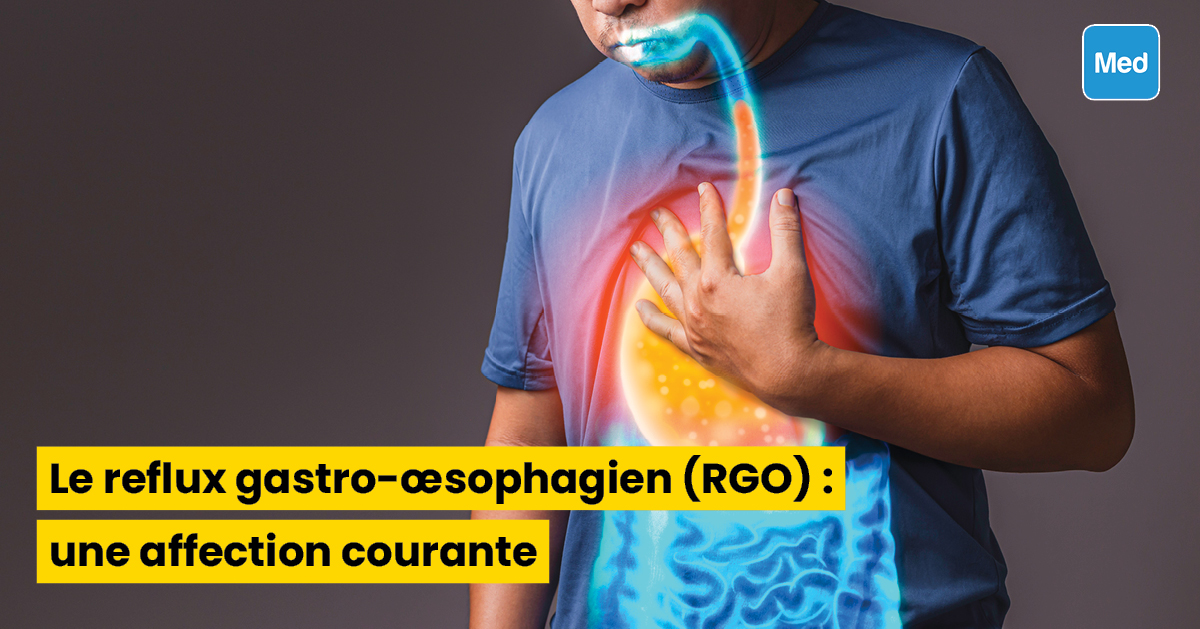Le reflux gastro-œsophagien (RGO) : une affection courante