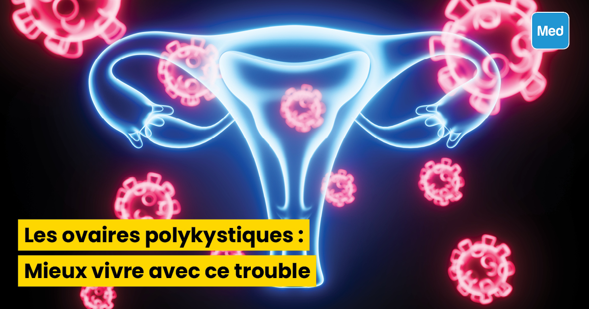 Les ovaires polykystiques : Mieux vivre avec ce trouble