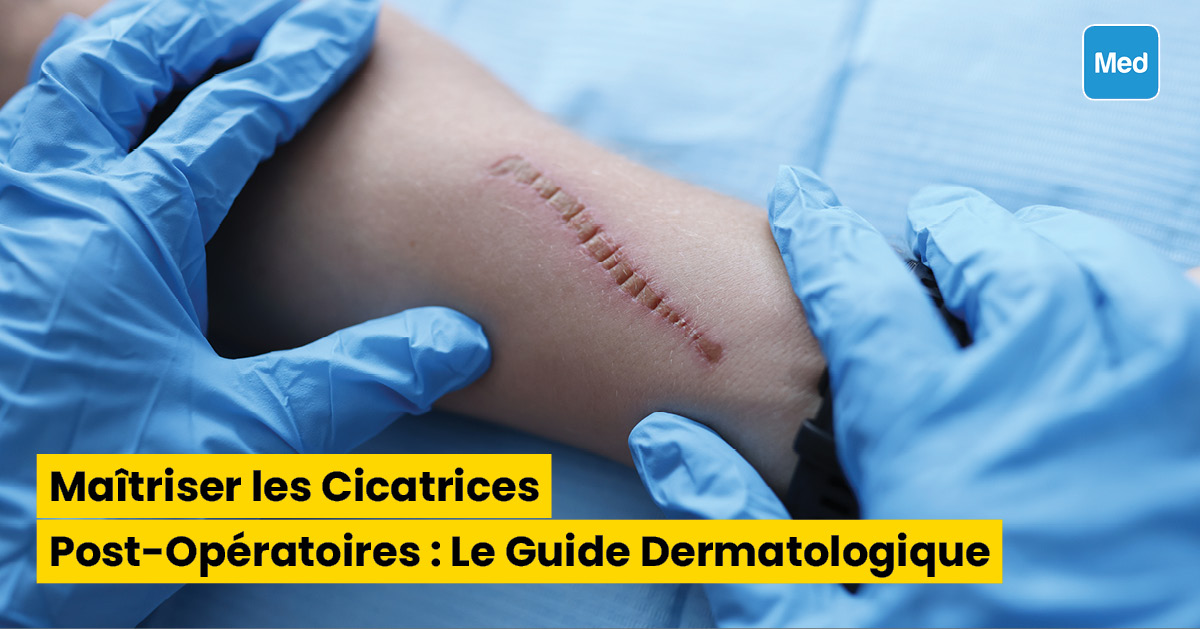 Maîtriser les Cicatrices Post-Opératoires : Le Guide Dermatologique
