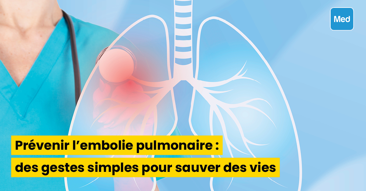 Prévenir l'embolie pulmonaire : des gestes simples pour sauver des vies