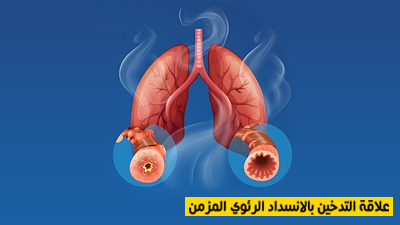 علاقة التدخين بالإنسداد الرئوي المزمن