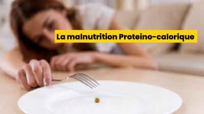 La malnutrition Proteino-calorique