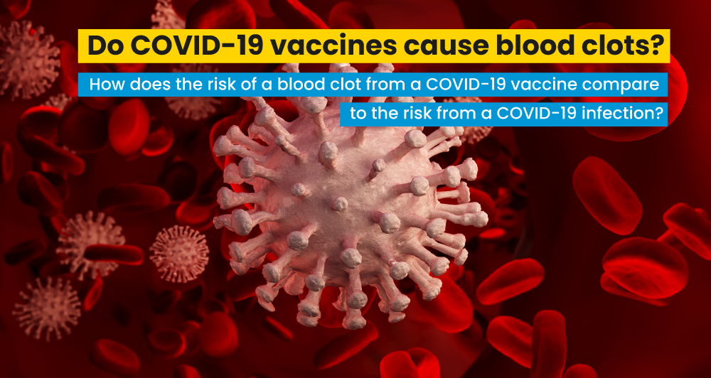 Do COVID-19 vaccines cause blood clots?