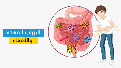 التهاب المعدة والأمعاء