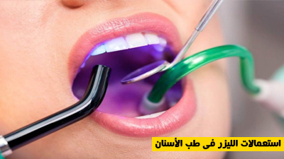 استعمالات الليزر في طب الأسنان
