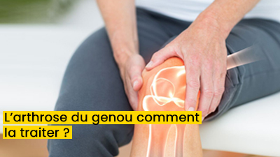 L’arthrose du genou comment la traiter ?