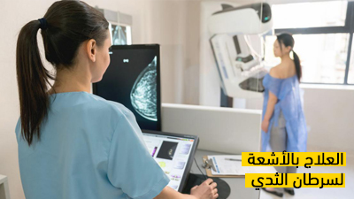 العلاج بالأشعة لسرطان الثدي