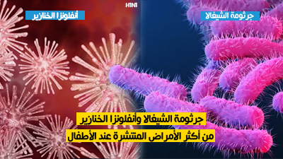 جرثومة الشيغالا وأنفلونزا الخنازير من أكثر الأمراض المنتشرة عند الأطفال