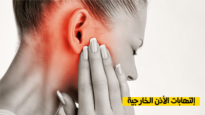 التهابات الأذن الخارجية