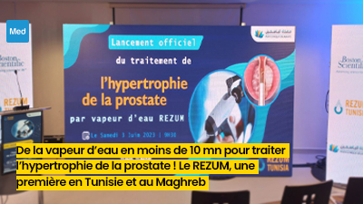 De la vapeur d’eau en moins de 10 mn pour traiter l’hypertrophie de la prostate ! Le REZUM, une première en Tunisie et au Maghreb
