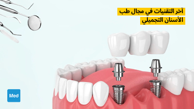 آخر التقنيات في مجال طب الأسنان التجميلي