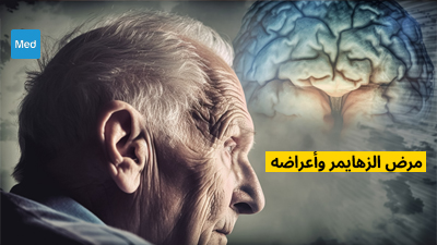 مرض الزهايمر وأعراضه