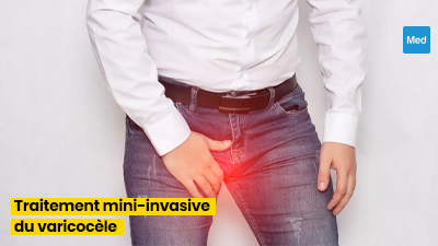 Le Traitement Mini-Invasif du Varicocèle : Une Révolution pour la Santé Masculine