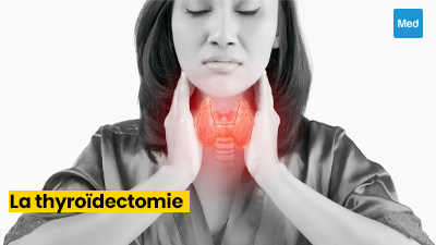 La Thyroïdectomie : Comprendre l