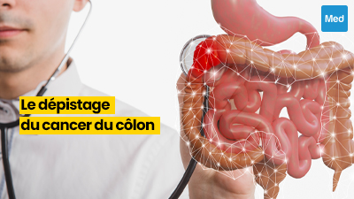 Le Dépistage du Cancer du Côlon : La Clé de la Prévention et de la Survie