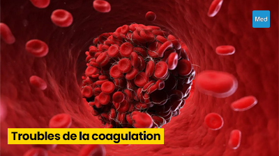 Troubles de la coagulation