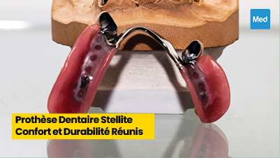 Prothèse Dentaire Stellite : Confort et Durabilité Réunis