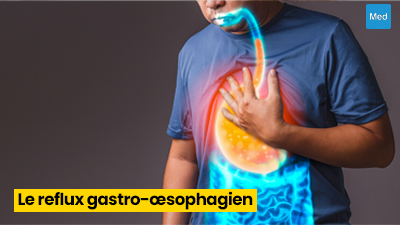 Le Reflux Gastro-Œsophagien (RGO) : comprendre et soulager ce trouble digestif fréquent