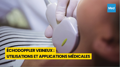 Échodoppler Veineux : Utilisations et Applications Médicales