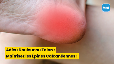 Adieu Douleur au Talon : Maîtrisez les Épines Calcanéennes !