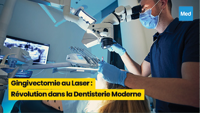 Gingivectomie au Laser : Révolution dans la Dentisterie Moderne