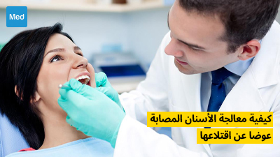 كيفية معالجة الأسنان المصابة عوضا عن اقتلاعها