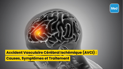 Accident Vasculaire Cérébral Ischémique (AVCI) : Causes, Symptômes et Traitement