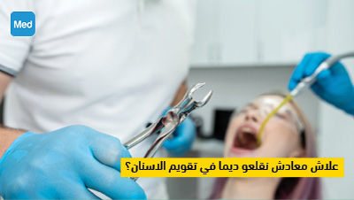 علاش معادش نقلعو ديما في تقويم الاسنان؟