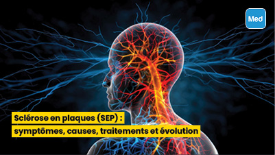 Sclérose en plaques (SEP) : symptômes, causes, traitements et évolution