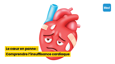 Le cœur en panne : Comprendre l