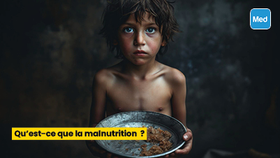 Qu’est-ce que la malnutrition ?