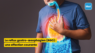 Le reflux gastro-œsophagien (RGO) : une affection courante