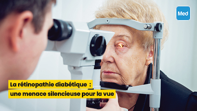 La rétinopathie diabétique : une menace silencieuse pour la vue