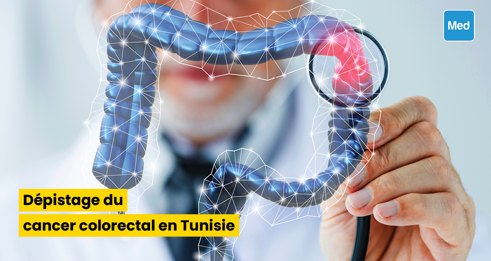 Dépistage du cancer colorectal en Tunisie 