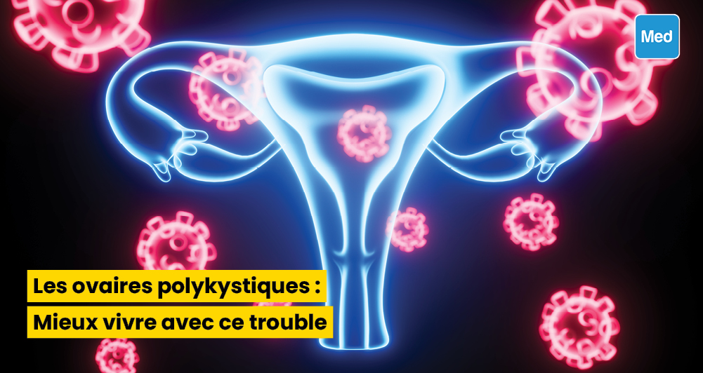 Les ovaires polykystiques : Mieux vivre avec ce trouble