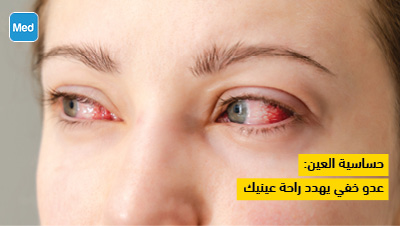حساسية العين: عدو خفي يهدد راحة عينيك