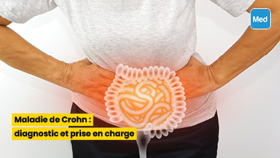 Maladie de Crohn : diagnostic et prise en charge