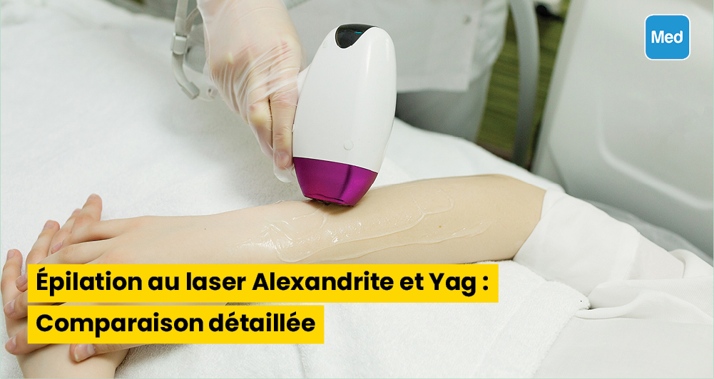 Épilation au laser Alexandrite et Yag : Comparaison détaillée