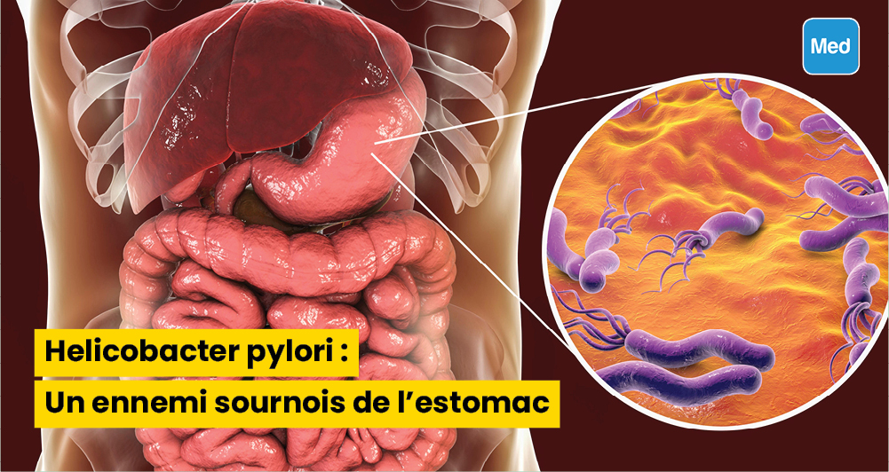Helicobacter pylori : Un ennemi sournois de l