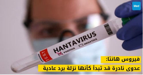 فيروس هانتا: عدوى نادرة قد تبدأ كأنها نزلة برد عادية