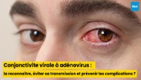 Conjonctivite virale à adénovirus : comment la reconnaître, éviter sa transmission et prévenir les complications ?