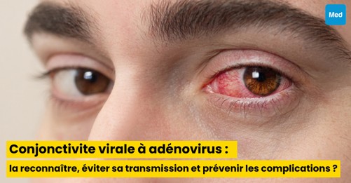 Conjonctivite virale à adénovirus : comment la reconnaître, éviter sa transmission et prévenir les complications ?