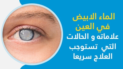 الماء الابيض في العين علاماته و الحالات التي تستوجب العلاج سريعا